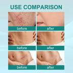 Scar Repair Spray
