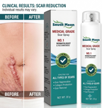Scar Repair Spray
